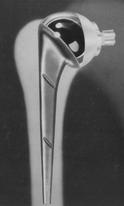 Shoulder, Total:  Modell-St. George  (Implant 376)